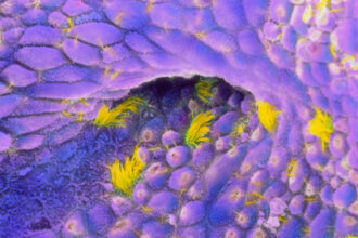 m8500247 sem of ovarian cancer cells spl