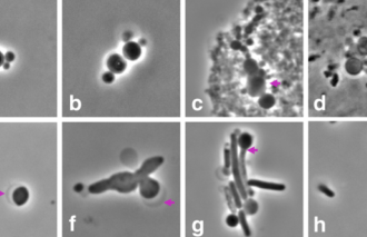 bactérias podem perder sua parede celular e mudar de forma e1569586120535
