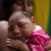 Este bebê no Rio de Janeiro nasceu com microcefalia após a mãe ter sido infectada pelo vírus Zika no início da gravidez. (Imagem: Antônio Lacerda/EFE/ NEWSCOM)