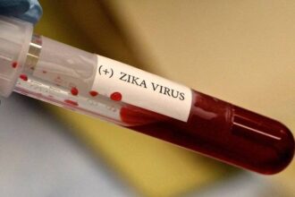 Zica vírus 1