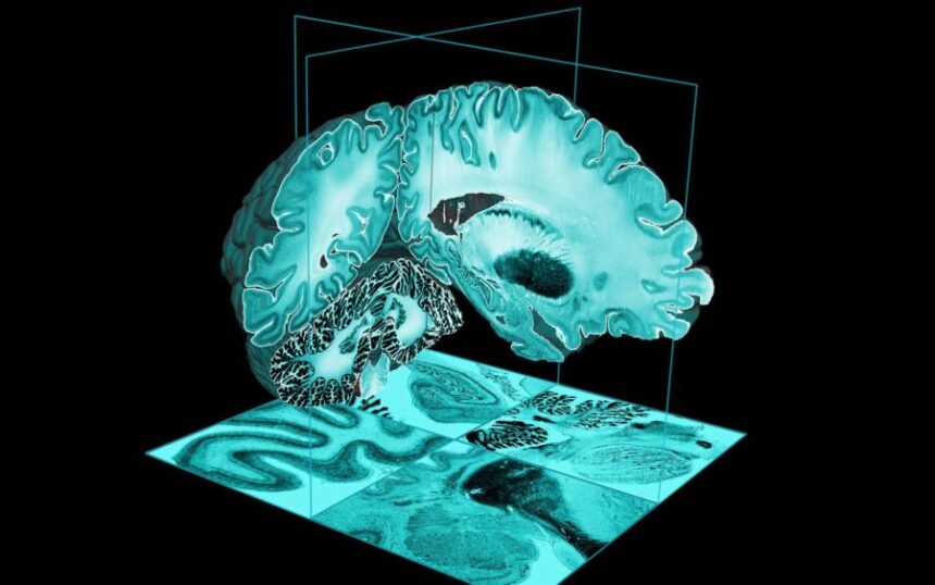 Atlas do cérebro humano scaled