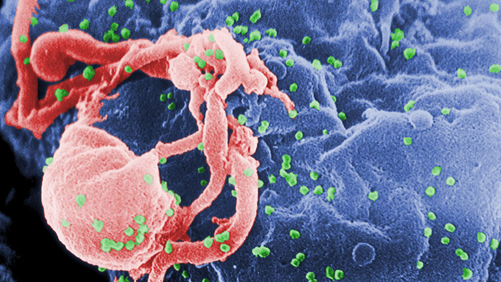 O exame de células de pacientes com HIV apelidados de controladores de elite.
