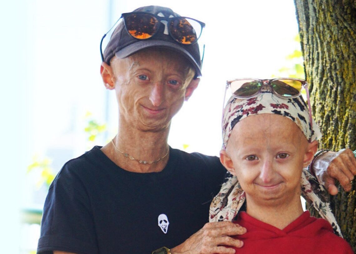 Pessoas com a doença genética progéria, como este irmão e irmã da Bélgica, envelhecem muito rapidamente e muitas vezes morrem antes dos 15 anos.

(THE PROGERIA RESEARCH FOUNDATION)
