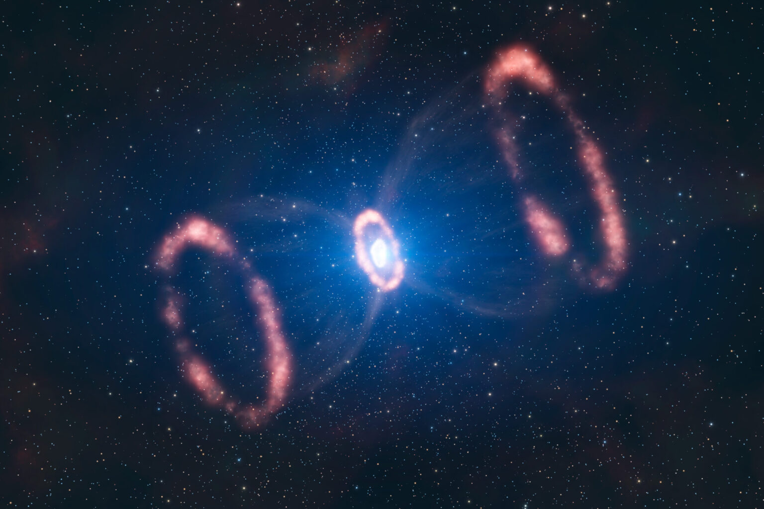 The material around SN 1987A scaled