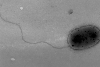 Micróbios desconhecidos encontrados na ISS