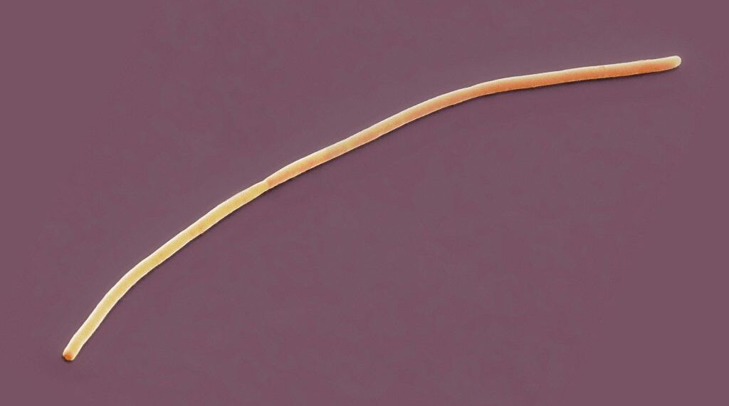 Uma bactéria recém-descoberta pode crescer até 2 centímetros de comprimento. A imagem mostra uma bactéria diferente com uma forma longa e fina Imagem: Getty Images