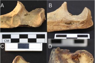 Esqueleto de mulher núbia que registra o mais antigo caso de artrite reumatoide já encontrado