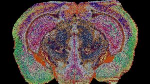 Corte transversal de cérebro em mosaico de pontos coloridos sobre fundo preto, com regiões em rosa, verde, laranja e azul.