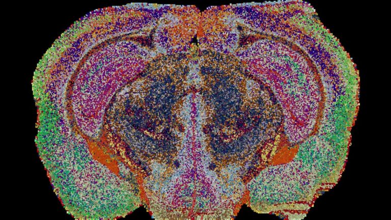 Corte transversal de cérebro em mosaico de pontos coloridos sobre fundo preto, com regiões em rosa, verde, laranja e azul.