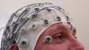 Perfil de uma pessoa com gorro branco de eletrodos e fios cinzas para registro de atividade cerebral por EEG.