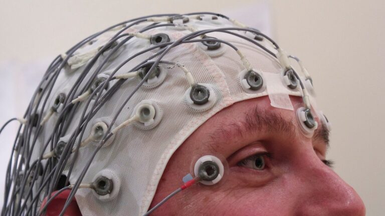 Perfil de uma pessoa com gorro branco de eletrodos e fios cinzas para registro de atividade cerebral por EEG.