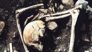 Ossada humana exposta em terra escura, com crânio rachado em primeiro plano e ossos longos e pedras ao redor.